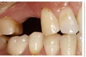 牙康安口腔医院怎么样?内含价格表及案例分析(图2)