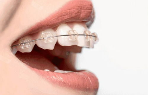 石家庄哪个医院矫正牙齿效果好？中诺口腔居榜首(图2)