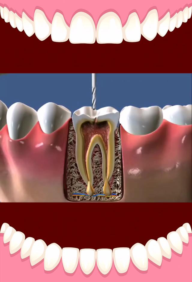 牙根发炎怎么快速消炎—牙根发炎怎么快速消炎止痛