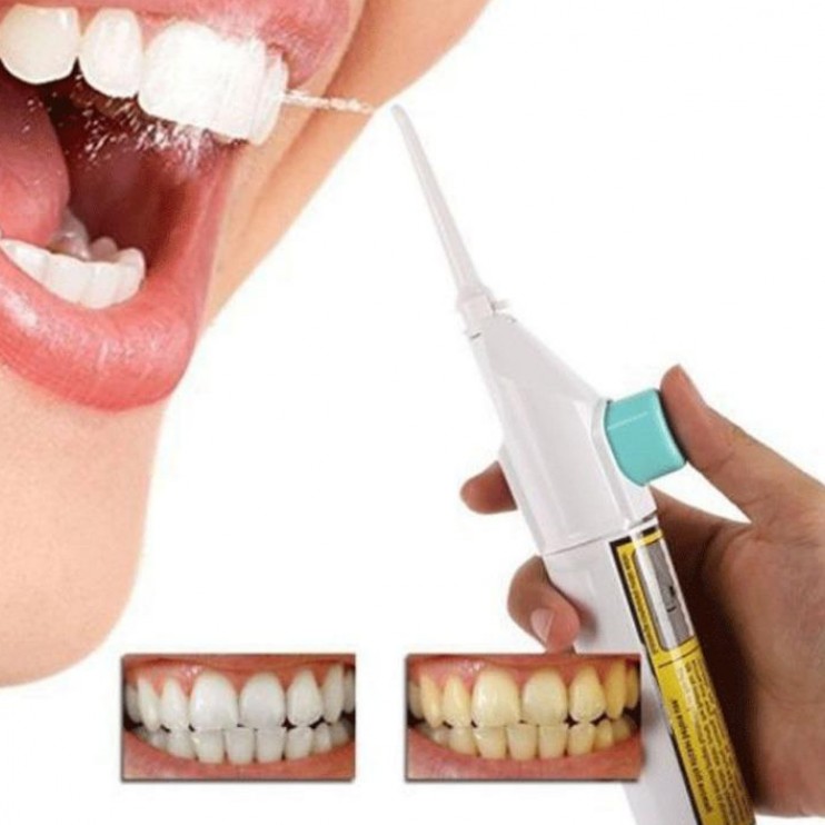 牙齿过敏怎么办;牙齿过敏怎么办较有效的方法(图3)