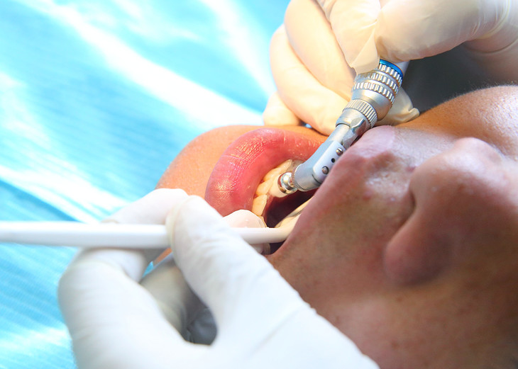 慢性牙周炎怎么治疗_慢性牙周炎怎么治疗较有效洗完牙牙还疼吃啥药好