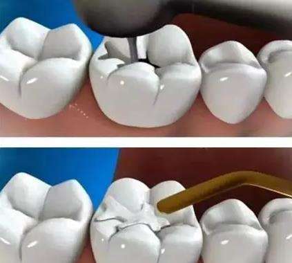 牙痛怎么治;了不起的修仙模拟器牙痛怎么治(图2)
