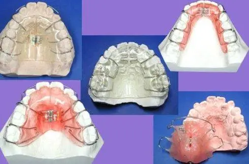 板牙松动疼痛怎么办_板牙松动疼痛怎么办儿童