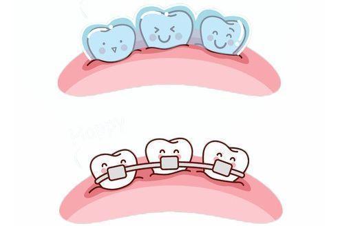 牙齿歪斜怎么矫正_牙齿歪斜怎么矫正多少钱