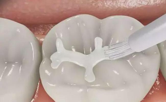 牙齿萎缩怎么才能恢复—牙齿萎缩怎么才能恢复整齐