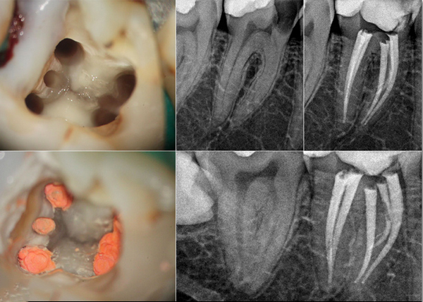 牙晚上疼白天不疼是怎么回事—牙晚上疼白天不疼是怎么回事 牙齿松动(图2)