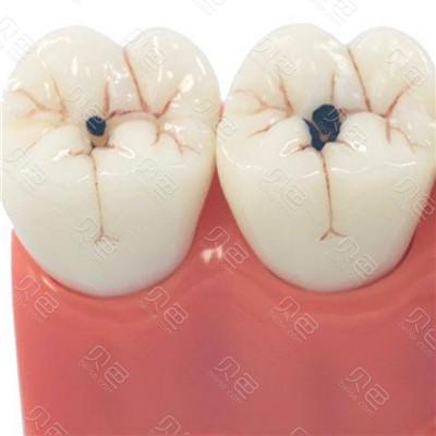 牙突出怎么矫正_牙突出怎么矫正视频