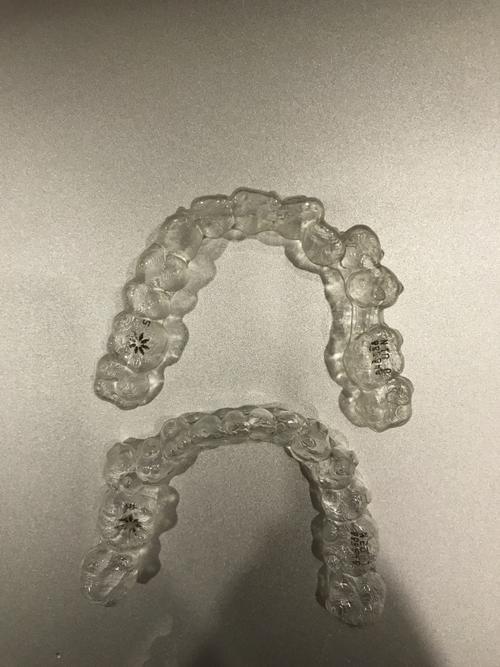 嘴突怎么矫正-嘴突怎么矫正小妙招(图2)