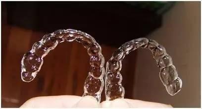 牙齿突出怎么矫正-牙齿突出怎么矫正需要拔牙吗(图3)