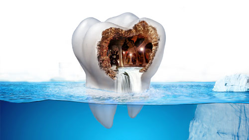 根尖炎怎么治疗、根尖炎怎么治疗较有效(图2)