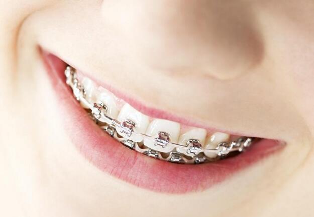 偏颌怎么矫正，偏颌怎么矫正方法