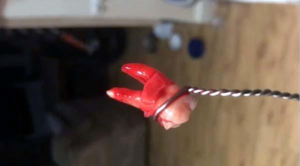 拔牙怎么拔的过程，拔牙怎么拔的过程不疼