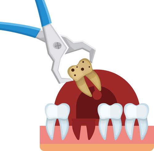 拔牙怎么走医保-拔牙怎么走医保报销流程