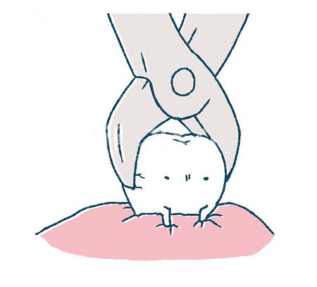 不拔智齿会怎么样_不拔智齿会怎么样拨前面的牙(图2)