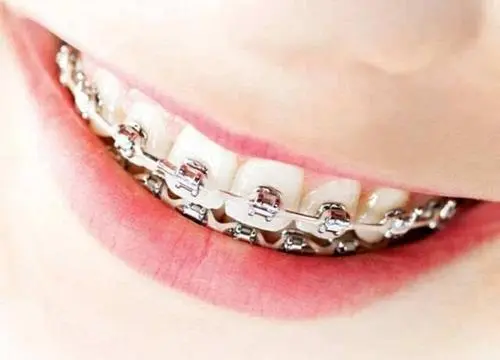 牙线棒怎么用;细滑牙线棒怎么用(图2)