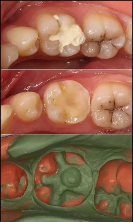 牙疼吃药不管用怎么办;牙疼吃药不管用怎么办呢？