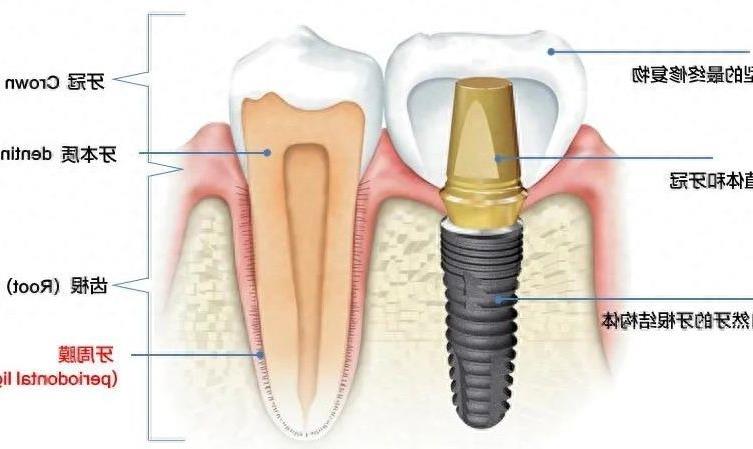 合肥卓雅口腔种植牙服务深度解析：技术先进、团队专业、价格亲民