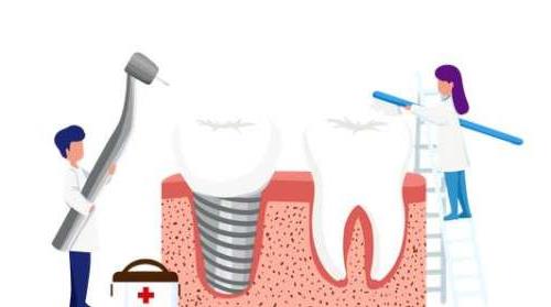 襄阳大众口腔种植牙服务:技术、价格与口碑解析(图2)