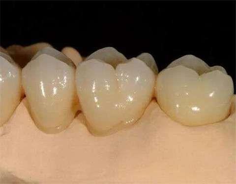 齐齐哈尔牙博士口腔全新收费标准大公开,种植牙价格起航4000元起(图1)