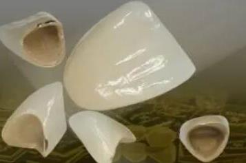 包头市口腔正畸医院推荐:专业医师团队与先进技术的结合(图1)