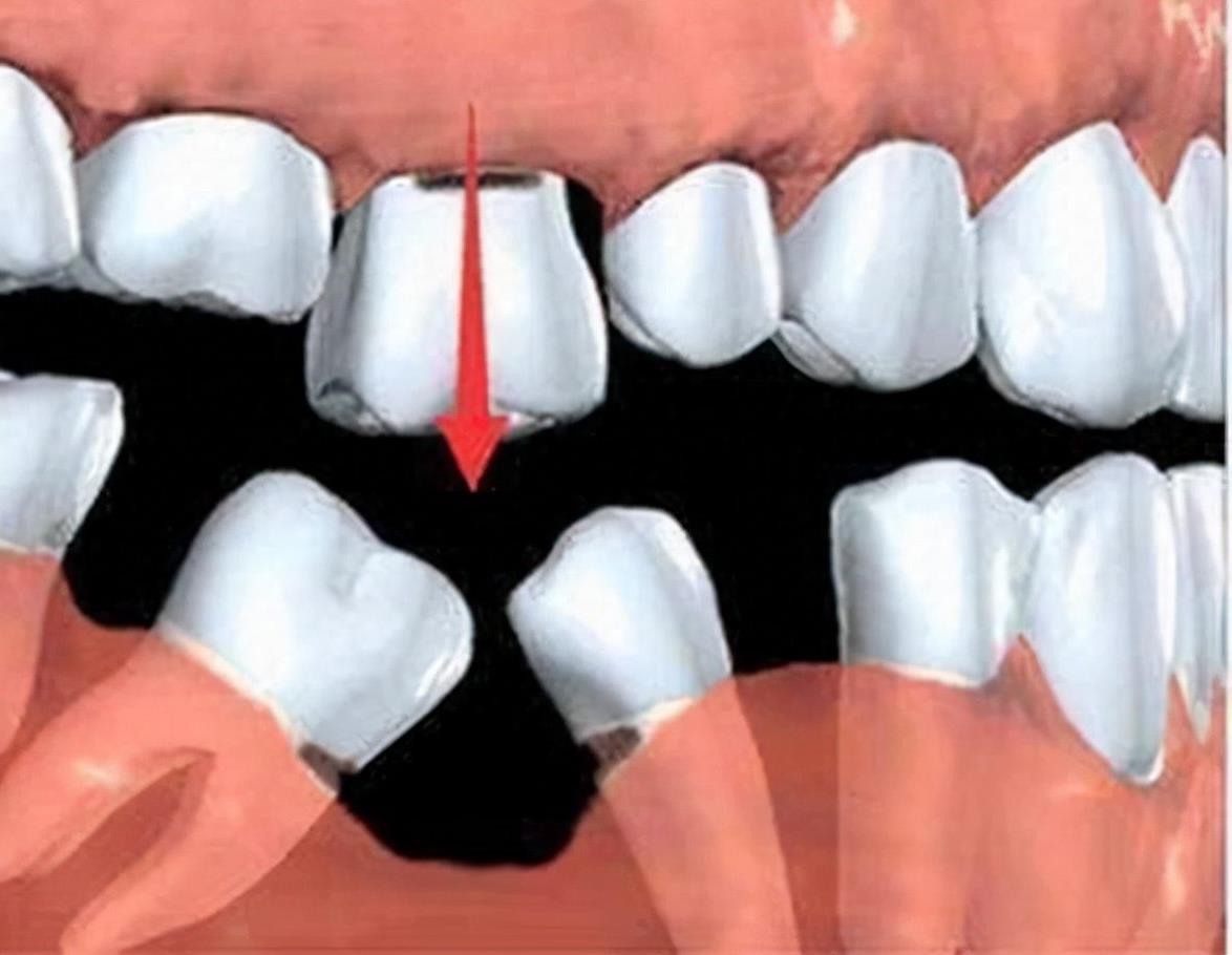 哈尔滨南岗区种植牙服务大比拼:五家口腔诊所深度解析(图1)