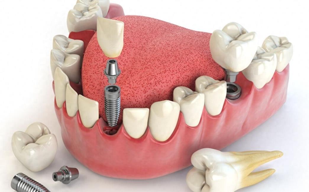 海口口腔医院服务价格全解析(图2)