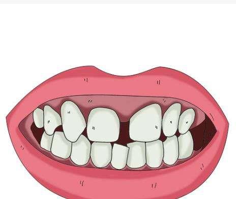 合肥卓雅口腔矫正服务解析:技术先进、医生专业、方案个性化、价格亲民(图1)