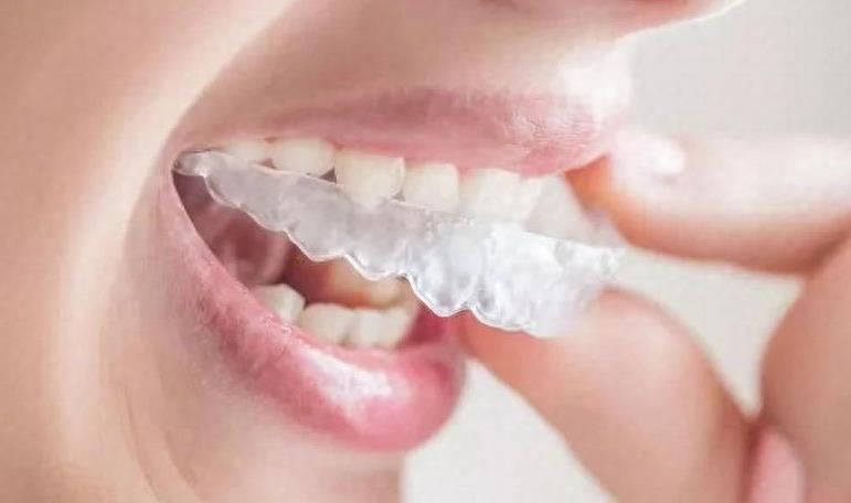 银川种植牙价格解析，各口腔医院价格一览