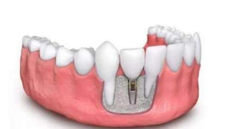 合肥松丰口腔:价格亲民,服务的口腔健康新选择(图1)