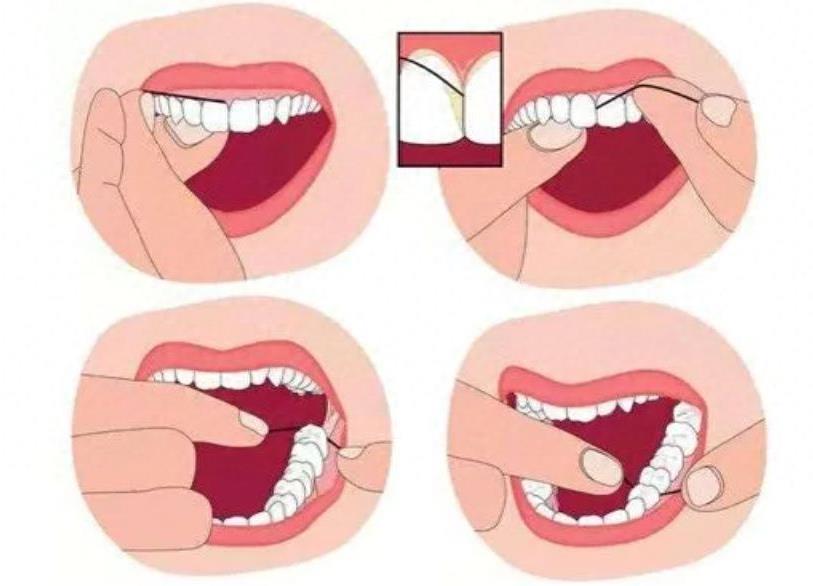 合肥隐形矫正牙套价格全解析：时代天使与隐适美品牌对比