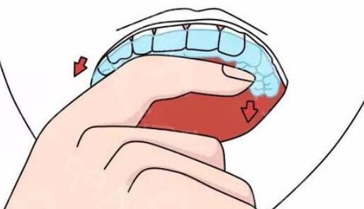 江门种植牙医院排名揭晓：三家顶尖口腔医院的深度解析(图2)