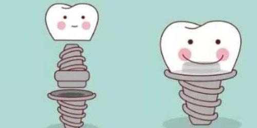 包头市口腔正畸医院推荐:专业医师团队与先进技术的结合(图2)