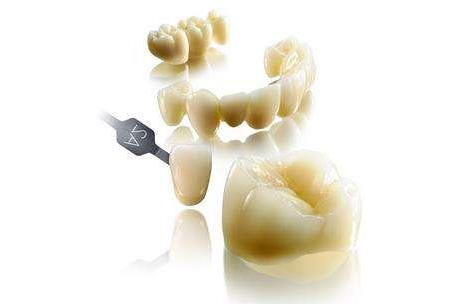 富阳口腔种植牙价格差异解析:从3000至8000元的深层原因探究(图1)