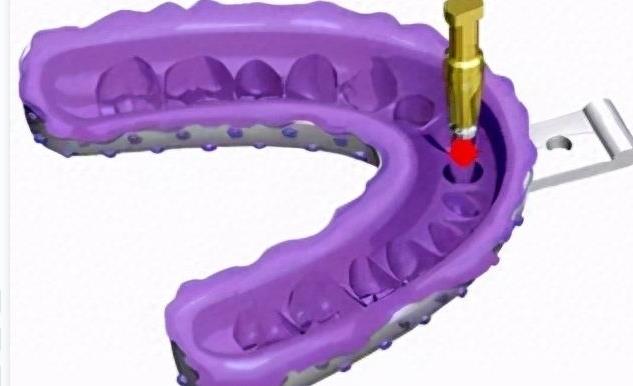 合肥中诺口腔医院价格全解析,看牙究竟需要花费多少?(图1)