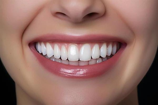 广州中家医家庭医生口腔种植牙技术全新解读及价格指南(图2)