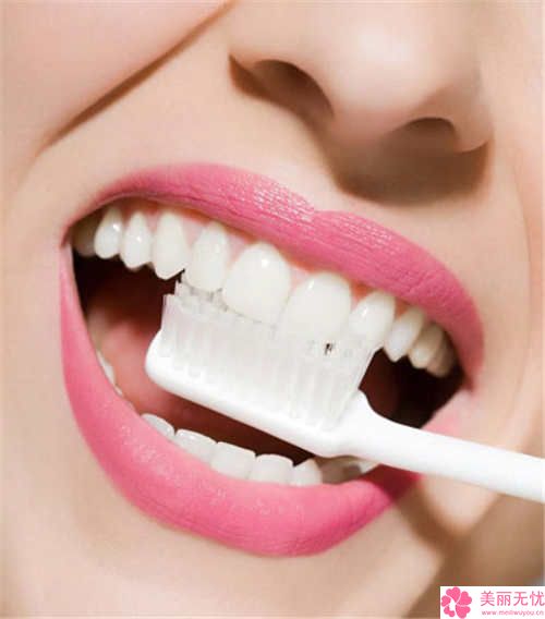 乐清口腔矫正医院指南：隐形、自锁与经济方案大比拼