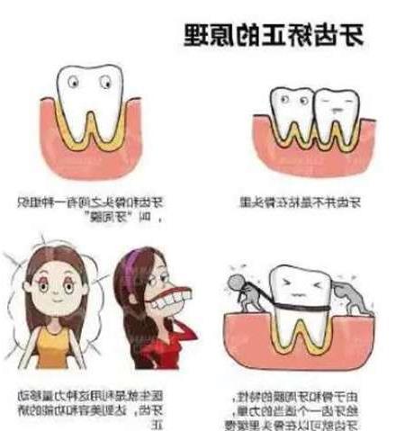 美国种植牙医院哪家好？这几家正规又，值得选择(图1)