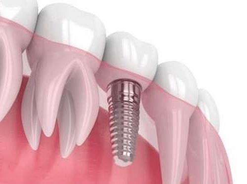 2024年玻尿酸注射医院排名推荐，全是正规可靠值得信任(图1)