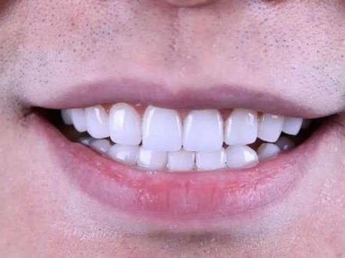 芜湖伊莱美口腔医院患者满意度调查：服务与价格的双重优势(图1)