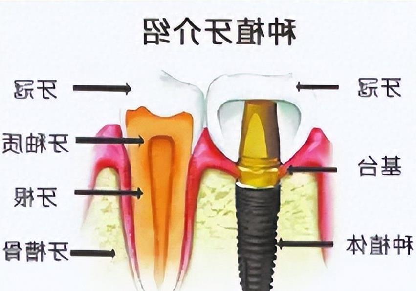 海南微笑口腔连锁品牌深度解析:口碑、服务与价格(图1)