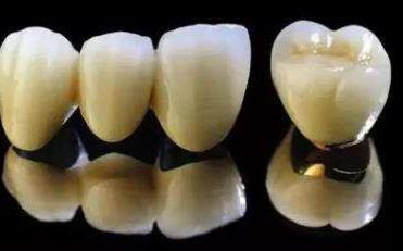 宜昌中广口腔医院:价格亲民,技术精湛,赢得牙友青睐(图2)