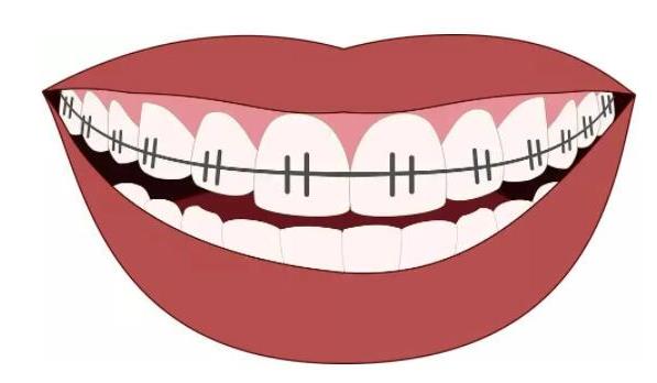 包头市种植牙价格全解析：国产至高端品牌价格一览