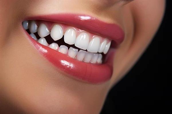 河池牙齿矫正全攻略:价格详解与个性化选择指南(图2)