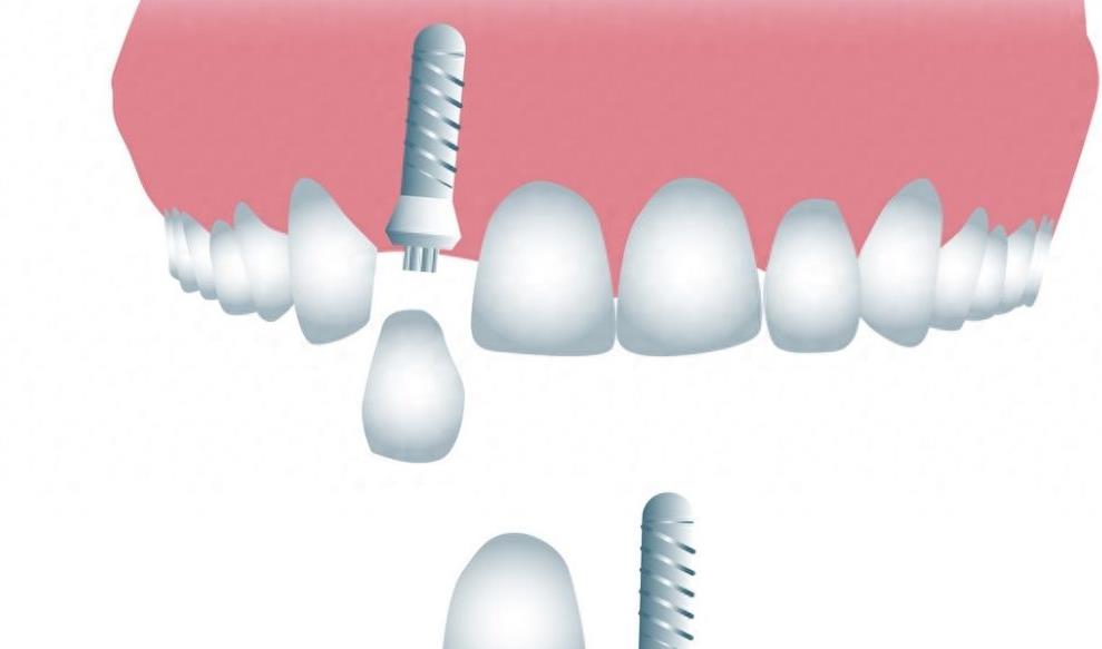 孝感植贝尔口腔全新价格一览：亲民价格，高品质服务(图1)