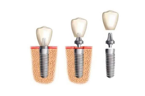 常德美奥口腔医院：价格亲民，技术领先，服务周到(图2)