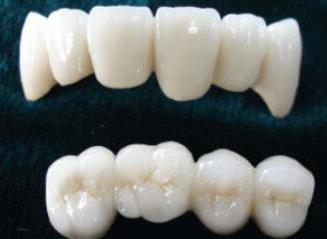 牙齿修复费用详解：不同修复方式的价格差异分析(图1)