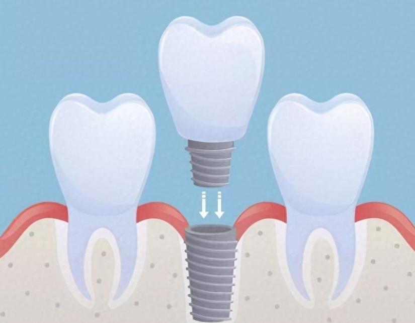 福州中泽口腔王庄店:价格与服务的深度解析(图2)