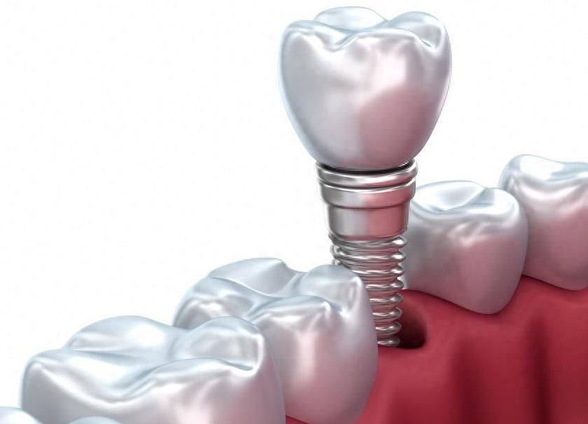 张家港牙齿矫正费用全解析:价格因素与选择指南(图2)