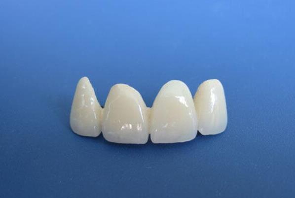 河池牙齿矫正全攻略:价格详解与个性化选择指南(图1)