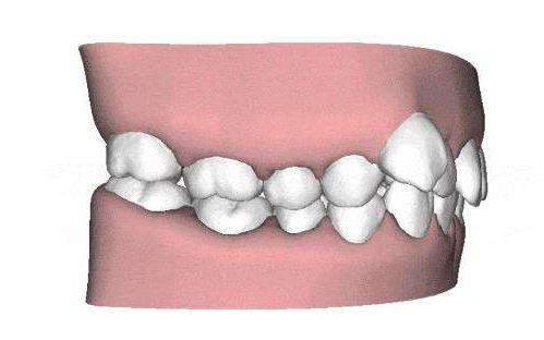 大连雅馨口腔诊所：服务与价格指南(图2)